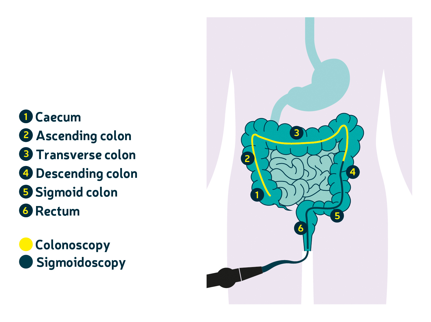 Hospital tests and colonoscopies Bowel Cancer UK Bowel Cancer UK